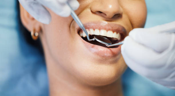 Best Emergency Treatment for Dental Infections or Abscesses in Lakewood, CO